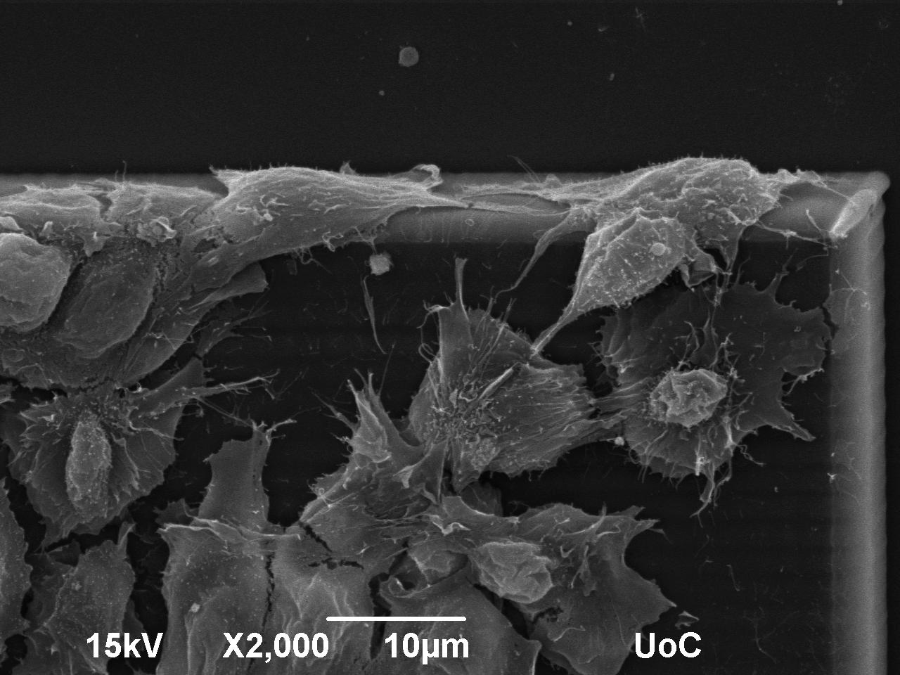 Osteoblastic cell attachment on a composite biomaterial surface shown by Scanning Electron Microscopy